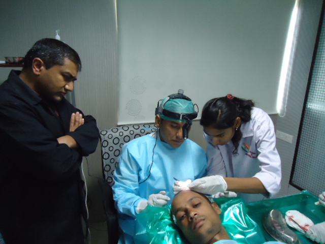 hair transplant clinic in delhi